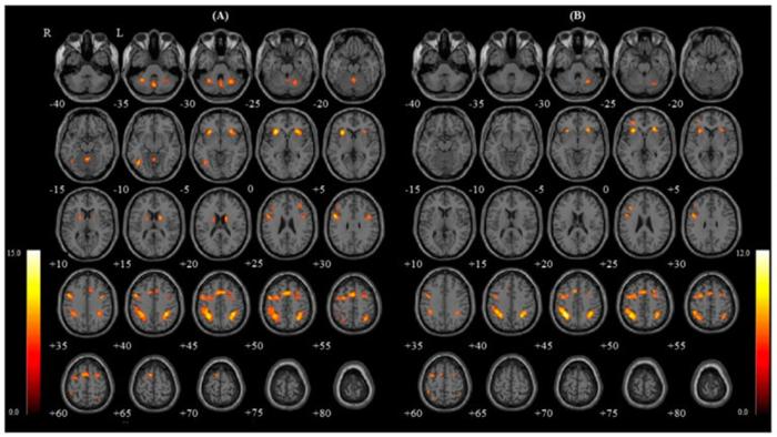 respirare con la bocca causa problemi cognitivi