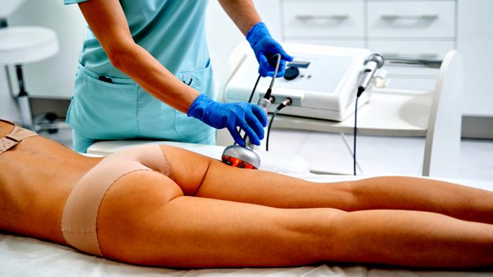 Cellulite: Strategie e Trattamenti Efficaci per Combatterla