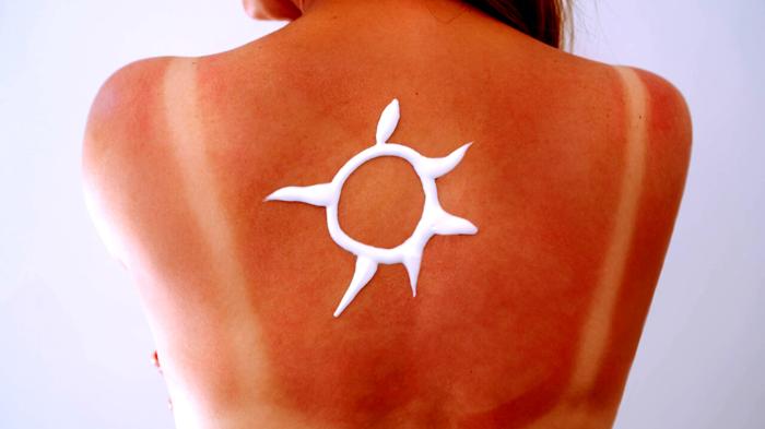 Esposizione al Sole durante la Terapia Antibiotica: Cosa Sapere