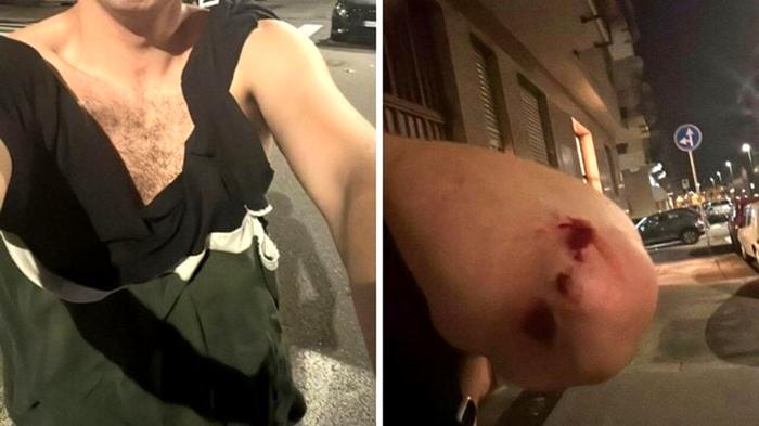 Giornalista aggredito a Torino: solidarietà e polemiche