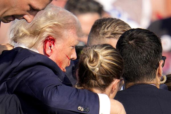 L'orecchio di Trump sanguinante dopo l'attentato. Foto Ap via LaPresse L'orecchio di Trump sanguinante dopo l'attentato. Foto Ap via LaPresse