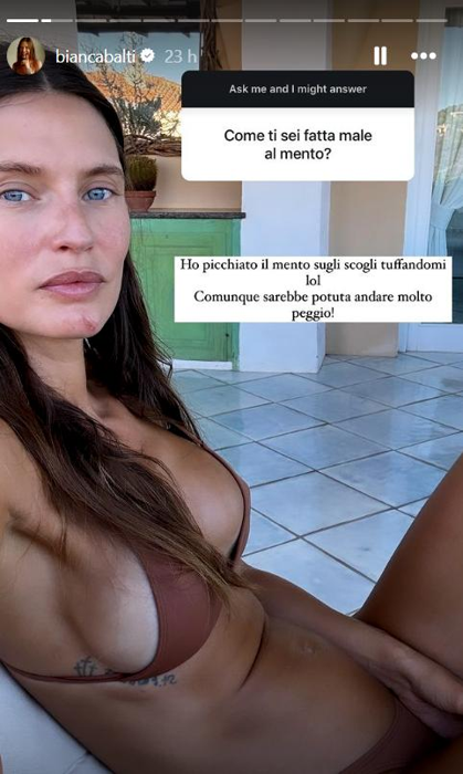 La storia di Bianca Balti 7 La storia di Bianca Balti 7