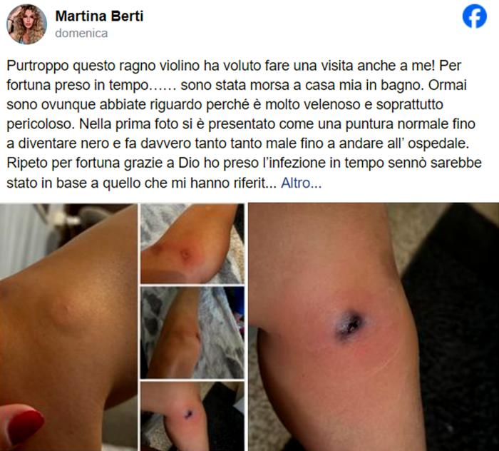 Martina racconta la sua esperienza su Fb martina berti racconto morso ragno violino