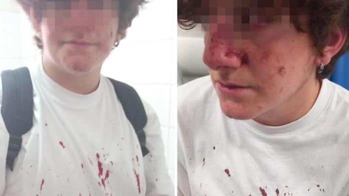 Ragazzo 16enne picchiato a Napoli: emergenza violenza giovanile