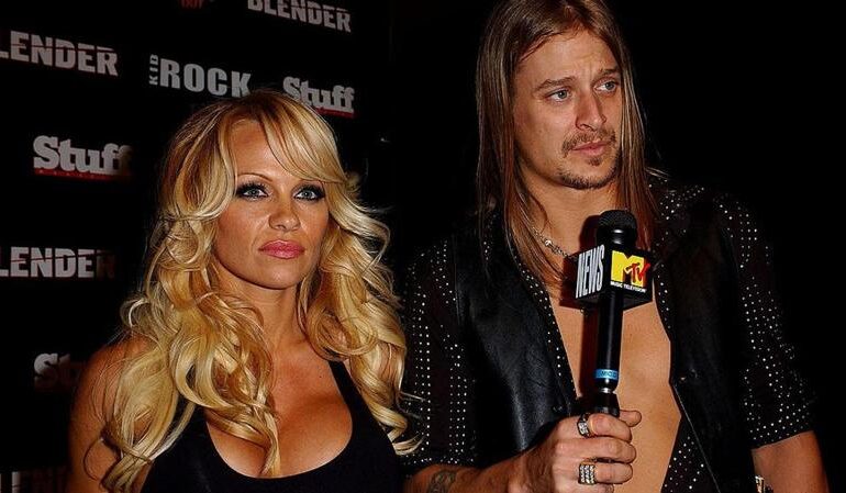 La rissa tra Kid Rock e Tommy Lee agli MTV Video Music Awards