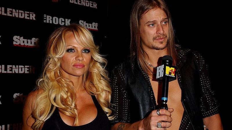 La rissa tra Kid Rock e Tommy Lee agli MTV Video Music Awards