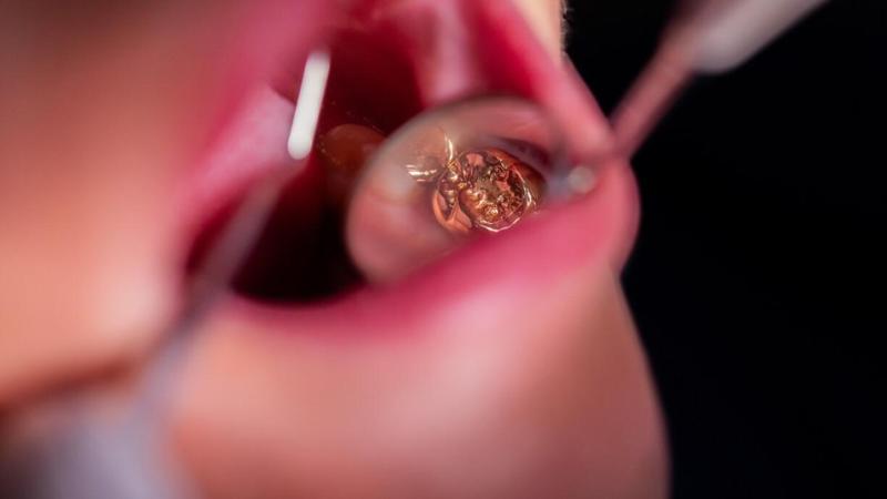 Oro dentale sottratto ai defunti: oltre 8 chili in 11 anni