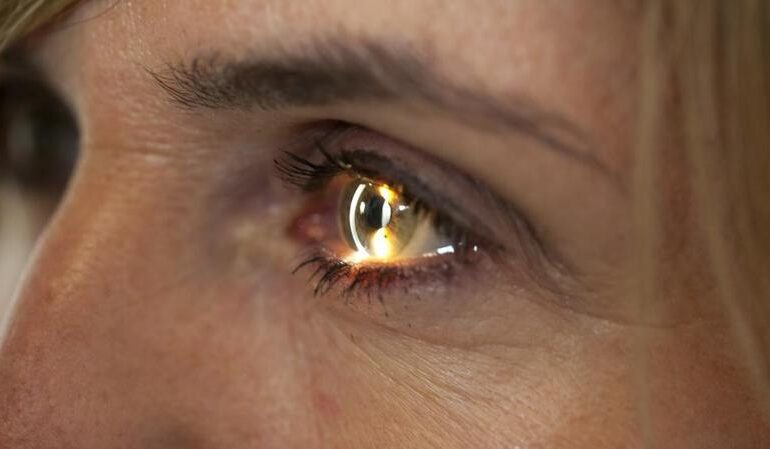 Retinite pigmentosa, la terapia che aiuta a distinguere gli oggetti