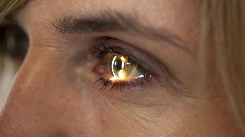Retinite pigmentosa, la terapia che aiuta a distinguere gli oggetti